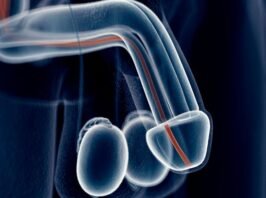Penile Augmentation