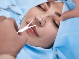 Rhinoplasty