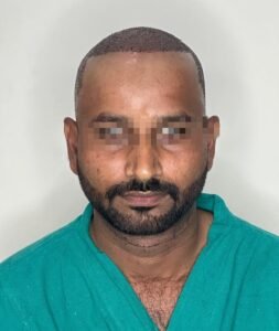 Procedure Hair Transplant