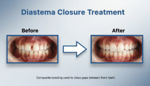 Distema Closure Treatment