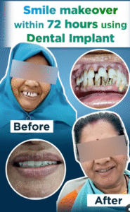 Smile Makeover